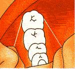 2) e o espaço entre eles deve ser de aproximadamente 3 cm par que os dedos fiquem próximos ao dente que ser limpo (Fig. 3 e 4).