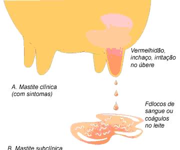 Clínica FORMAS DE MANIFESTAÇÃO DA MASTITE Sinais evidentes de inflamação (edema, aumento temperatura, grumos, alteração das características do leite) Pode