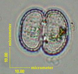borgei Krieger Célula: 25 x 20 µm 98 Fot.