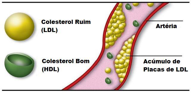 o LDL colesterol (colesterol ruim) o HDL (colesterol bom) os triglicérides risco maior