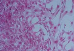 Pela coloração com HE podemos demonstrar que as células de fibroblasto NIH3T3 aderem e proliferam sobre o filme de BPU.