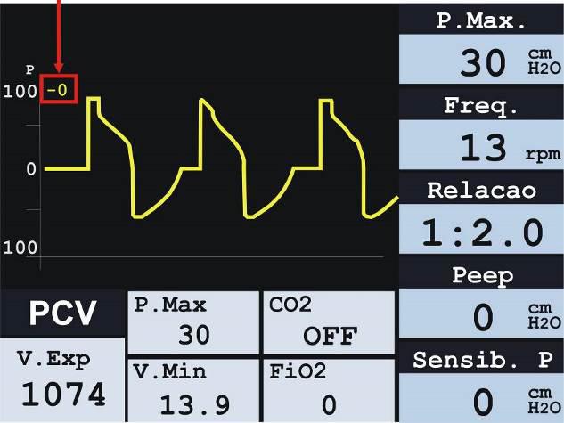 Operação Fluxo monitorado em l/min (litros por minuto) Figura 133: gráfico fluxo x tempo Volume monitorado em ml (militros) Figura 134: gráfico volume