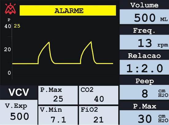 Sistema de Alarmes Ajuste Gases - A tela de ajuste de gases permite ajustar os limites inferior (BAIXO) e superior (ALTO) dos alarmes de gases inspirado e expirado.