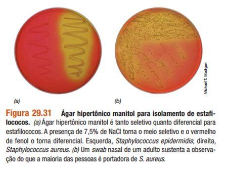 Cultivo da MRSA Meio seletivo e diferencial 7,5% de NaCl Manitol Vermelho de fenol