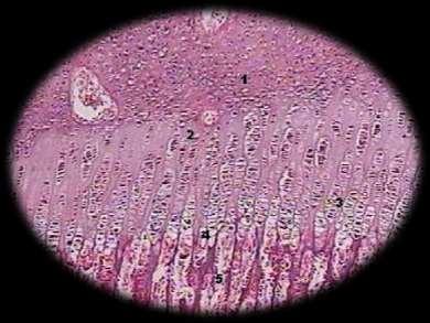 Histogênese do osso (Ossificação) Ossificação intramembranosa (interior de membrana conjuntiva) Ossificação endocondral (a partir de molde