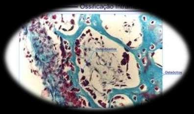 Ossificação Intramembranosa Surge no interior de membranas do Tecido conjuntivo.