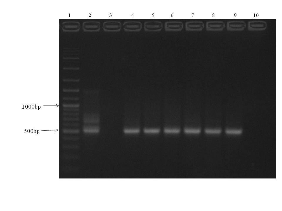 Figure 1. PCR results for Anaplasma platys detection in dog samples from Porto Alegre, Brazil. Lane 1, molecular weight marker (100bp, Invitrogen Corp.); Lane 2, A.