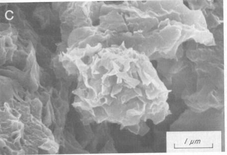 ESMECTITAS Argilominerais 2:1 expansivos d= 1,0 a 2,0 nm d= distância basal= 1,0 nm d= distância basal= 2,0 nm Mineral 2:1 expansivo (esmectita) Água ESMECTITAS Argilominerais 2:1 expansivos d= 1,0 a