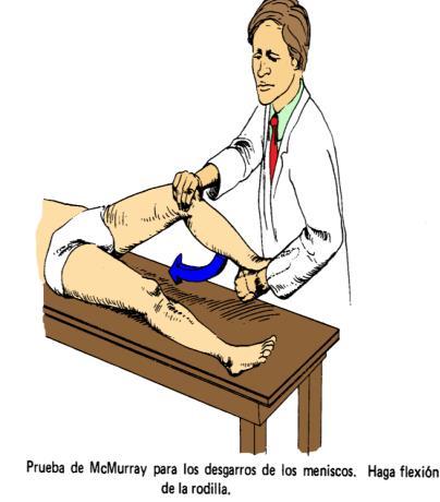 Esta manobra reduz a pressão sobre os meniscos e exerce tensão ligamentar. Se há lesão de ligamentos o paciente se queixará de dor, se a lesão é meniscal a manobra diagnóstica aliviará o sintoma.