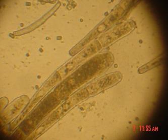 5 - Gregarinas Principais características Parasita que vive no intestino dos