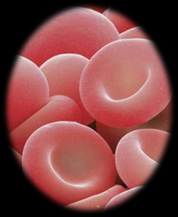 Hemorragia PATOGÊNESE Perda do volume sanguíneo, proteína plasmática e de hemácias.