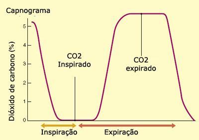 5 Figura 2 - Gráfico do capnograma. 5 Os capnógrafos são classificados conforme o sinal do CO2 é expresso.