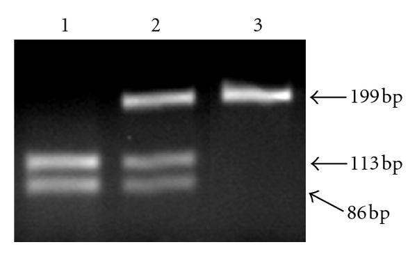 REAÇÃO EM CADEIA DA POLIMERASE Presença de DNA de vírus, bactéria