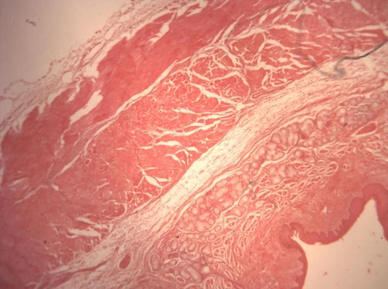 AULA PRÁTICA DE SISTEMA DIGESTÓRIO IMAGENS: Historep LÂMINA K1 ESÔFAGO HE O esôfago é constituido por: TÚNICA MUCOSA Composta por tecido epitelial de revestimento plano estratificado não