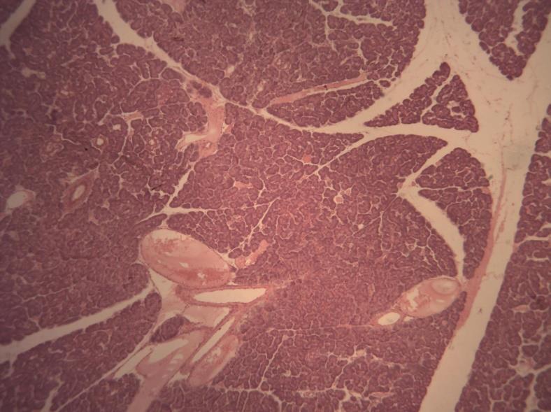 LÂMINA K7 PÂNCREAS HE O pâncreas apresenta uma cápsula conjuntiva muito delgada que envia finos septos para o interior do órgão delimitando incompletamente os lóbulos pancreáticos.