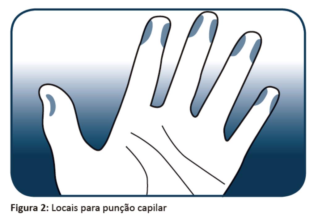 Como faço o teste de glicemia? 1. Passar álcool swab no dedo, priorizando o anelar, no sentido da ponta para a base (Figura 2)