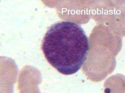 seguida formam-se os eritroblastos policromáticos, porteriormente, os eritroblastos ortocromáticos que darão origem aos reticulócitos e então por fim, são convertidos em eritrócitos maduros e