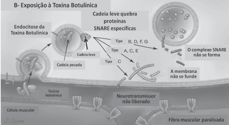 Exposição à Toxina Botulínica