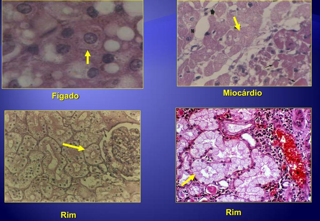 -Microscópicas: citoplasma opaco, granuloso, turvo, refringente,