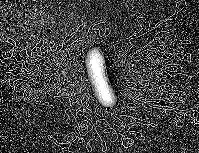 Brucella abortus 2 cromossomos diferentes http://www.sciencebuddies.