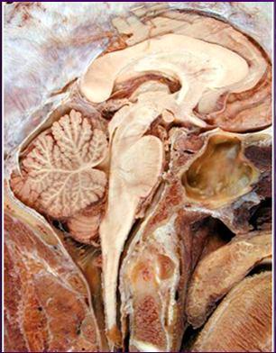 Divisões do Sistema Nervoso Divisões do Sistema Nervoso CRITÉRIO FUNCIONAL SISTEMA NERVOSO SOMÁTICO - PORÇÃO AFERENTE (SENSITIVA) - PORÇÃO EFERENTE (MOTORA)