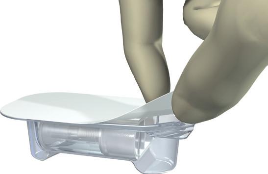 4.4 Inserção do implante 1 4.4.1 Abertura da embalagem do implante 1ª etapa Abertura da embalagem blister e remoção do porta-implante Nota: a embalagem blister assegura a esterilidade do implante.