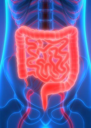 Mudança no hábito intestinal (a pessoa começa a ter diarreia ou prisão de ventre que não passam e não têm causa aparente) Sensação que o intestino não esvaziou após evacuar Sensação de empachamento