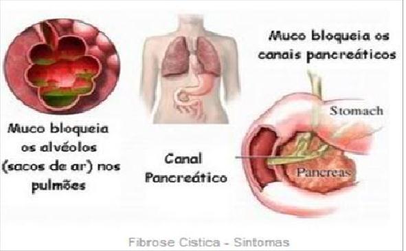 CAUSAS X SINTOMAS Destruição