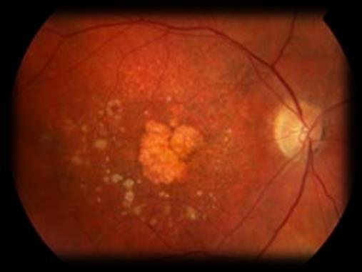 consulta de retina médica