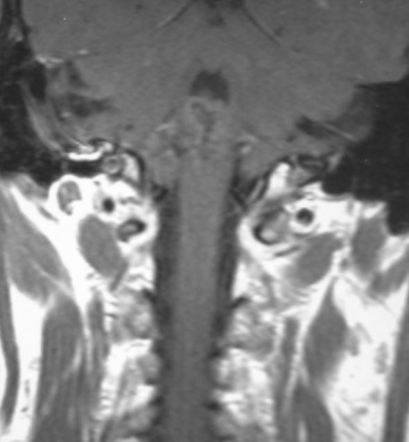 Lig. Longitudinal anterior Corpo vertebral Lig.