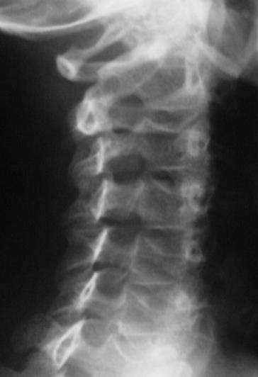 Radiografia obliqua