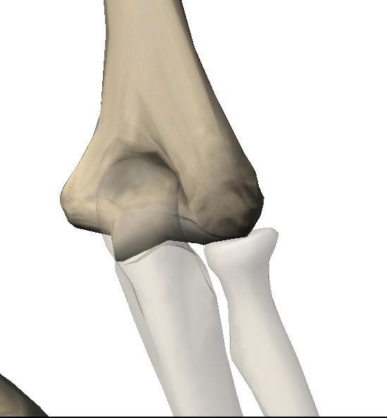 UMERO (HUMERUS) fosseta olecraniana olecrâneo fosseta coronoideia Apófise coronoideia A tróclea umeral é limitada, atrás e em cima, pela fosseta olecraniana (Fossa olecrani), que recebe o olecrânio