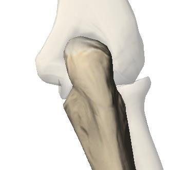 CÚBITO / ULNA Bordo posterior Este bordo tem a forma de um S itálico, dando inserção, nos seus três quartos superiores, aos músculos flexor comum profundo dos dedos, cubital anterior e