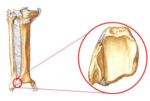 4 Anatomia do sistema articular 4.1 Articulação tibiofibular distal Articulação fibrosa (não possui cartilagem articular) composta entre a parte distal da fíbula e a parte distal da tíbia.