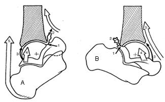 Está limitada por fatores ósseos (contato do tubérculo posterior do talus contra a margem posterior da tíbia também chamado 3º maléolo), capsulares e ligamentares (tensão da parte anterior da cápsula