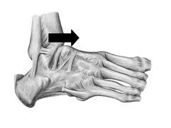 10.1.1 Disfunções da articulação tibiofibular distal 10.1.1.1 - Disfunção de anterioridade da tibiofibular distal Nessa disfunção a região distal da fíbula tem restrição do movimento no sentido posterior em relação à tíbia.