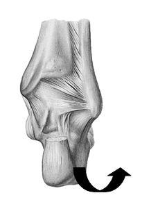 Representação esquemática da disfunção póstero externa do calcâneo ESSA DISFUNÇÃO FAVORECE: - Rotação medial da tíbia - Genu valgo (lateralidade interna) - Rotação medial coxofemoral - Ilíaco