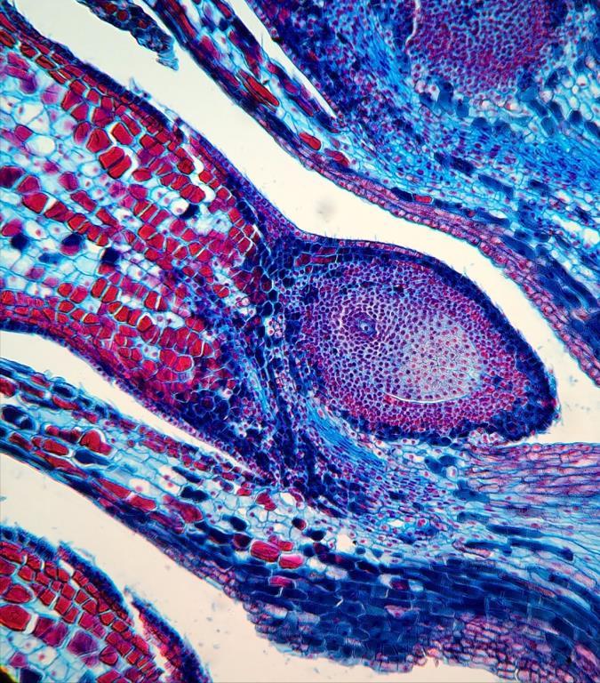 Note no detalhe, a escama ovulífera portando em sua face adaxial um óvulo com micrópila (seta) proximal, tegumento e