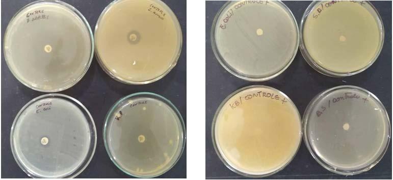 aureus, utilizando a difusão em disco do qual se obteve efeito inibitório com formação de halo a 8mm, já para a bactéria gram-negativa Pseudomonas aureginosa demostrouse sem atividade inibitória nas