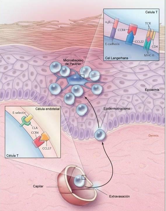 CÉLULAS DE LANGERHANS Entre as células da epiderme estão as células de Langerhans, cuja função é reconhecer e destruir