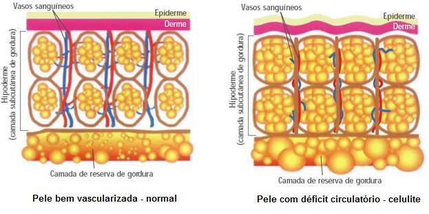 A CULPA É DO ESTROGÊNIO O estrogênio aumenta o número e o tamanho dos adipócitos, células que armazenam gordura e constituem o tecido celular subcutâneo.
