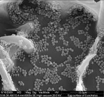 hilare através da técnica de fluorescência de hibridização in situ ou FISH realizada por PRADO et al., (2010).