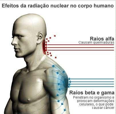 Queimaduras por radiação Queimaduras por radiação: são causadas pela