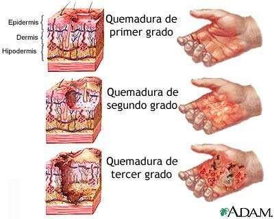 Profundidade 1º