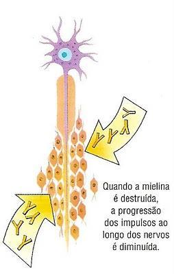 Campylobacter - DOENÇA Complicações: Septicemia, meningite, artrite.