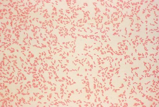 Yersinia enterocolitica - AGENTE Enterobactéria: bacilo Gram negativo, não esporulado, anaeróbio