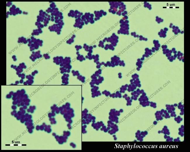 Staphylococcus aureus - AGENTE Cocos Gram positivos; Anaeróbios facultativos (mas desenvolvem-se melhor em aerobiose); Mesófilos; Facilmente destruídos