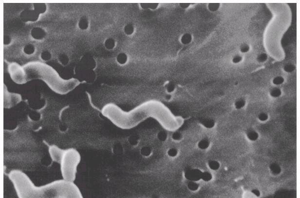 Campylobacter - AGENTE Ainda doença emergente: Técnicas de isolamento disponíveis a partir dos anos