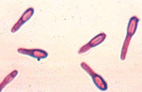 Clostridium botulinum Bacilos Gram positivos; Anaeróbios estritos => vácuo e conservas são favoráveis ao seu desenvolvimento; Esporulados; Termófilos; Neurotoxina; Esporos termoresistentes => >120