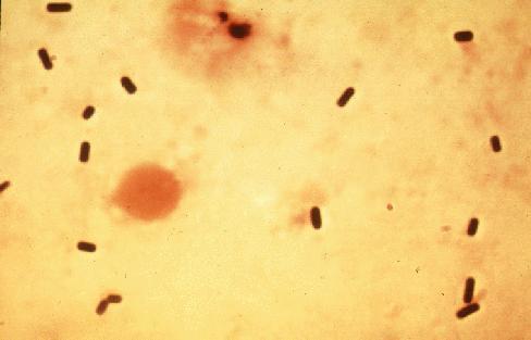 Clostridium perfringens Características Bacilo Gram +, esporulado, anaeróbio Ubiquitária, esporos podem-se disseminar, pelo solo (origem telúrica), poeiras em suspensão e